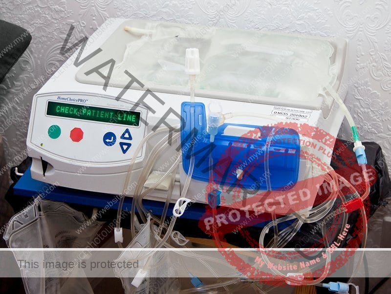 What Is The State Of Art For Portable Dialysis Machines