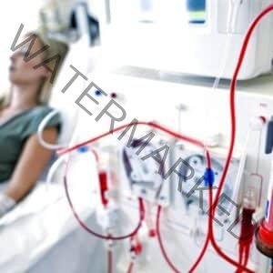 complications of dialysis